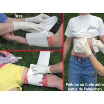 Intervention avec notre Coussin Hémostatique COUPE HEMO